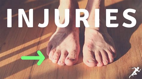 20 years of running injuries explained and analyzed youtube