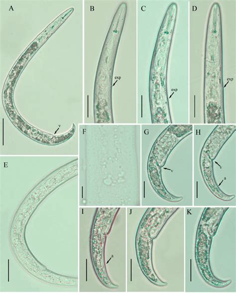 Light Photomicrographs Of Paratylenchus Neoprojectus Females A