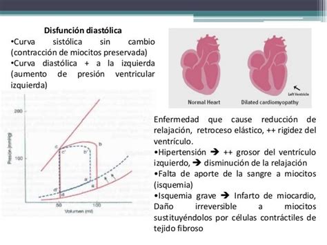 Insuficiencia Cardiaca Congestiva Fisiopatología