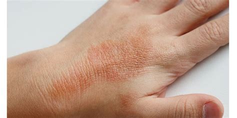 Como Identificar Doenças Graves Na Pele Ou Através Dela Dicas Da Jaque
