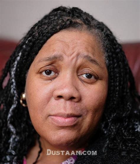 زن سیاهپوستی که با شیمی درمانی سفید پوست شد تصاویر مجله اینترنتی دوستان