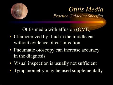 Ppt Clinical Guidelines Acute Otitis Media Powerpoint Sexiz Pix