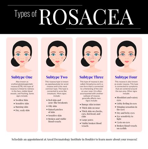 Rosacea Treatment General Dermatology Services In Boulder Azeal Dermatology Institute