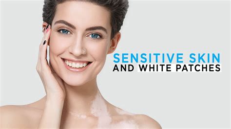 Sensitive Skin And White Patches Aimil Healthcare Dr Nitika
