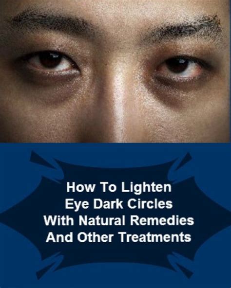 How To Lighten Skin Under Eyes Resipes My Familly