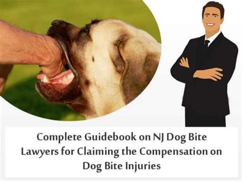 Complete Guidebook On Nj Dog Bite Lawyers For Claiming The Compensation