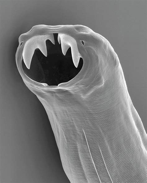 Dog Hookworm Buccal Capsule Photograph By Dennis Kunkel Microscopy