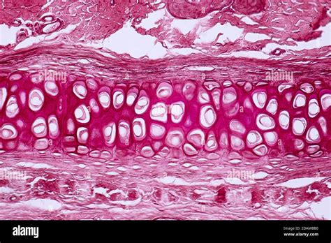 Human Cartilage And Bone Light Micrograph Stock Photo Alamy