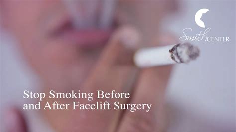 Why Smokers Should Stop Smoking Before And After Facelift Surgery ­ Houston Smith Center Youtube