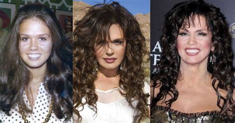 Marie Osmond Plastic Surgery Before And After Pictures 2024