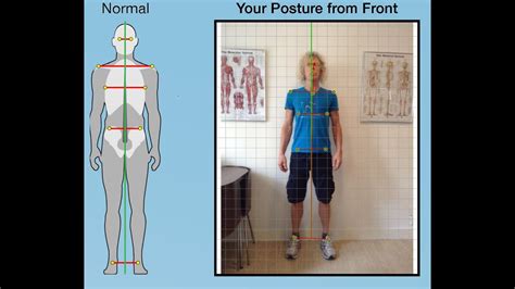 Postural Assessment Guide Youtube