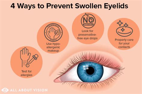 Swollen Eyelid Treatment And Prevention All About Vision