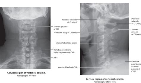 Cervical Spine X Ray Anatomy Anatomical Charts And Posters