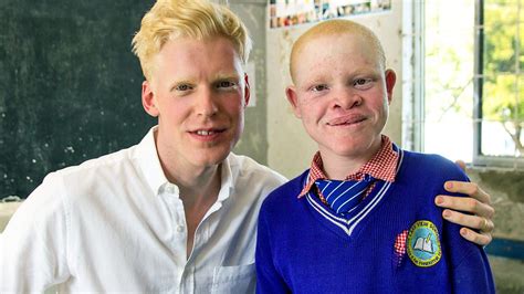 White Albino People