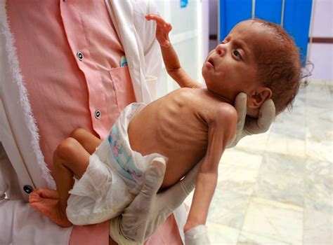 ‘perfect storm 2020 could be worst year yet for hunger in yemen with millions on brink of