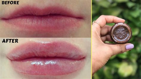How To Get Fuller Lips At Home Remedies Turlock How To Get Fuller