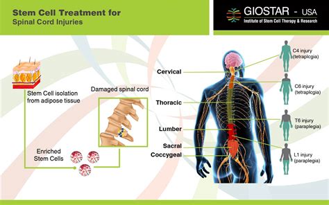 What Is The Best Treatment For Spinal Cord Injury Atoallinks