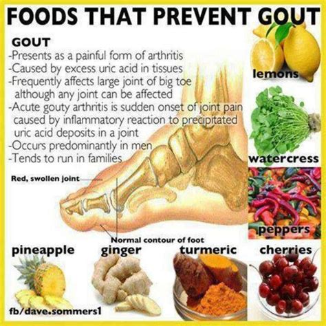 Occurence And Prevention Of Gout What Foods To Avoid And Which Foods