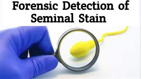 Forensic Detection Of Seminal Stainsdifferent Methods Of Semen