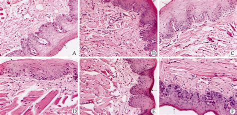 Histological Images Of The Buccal Mucosa Of The Left Side And The