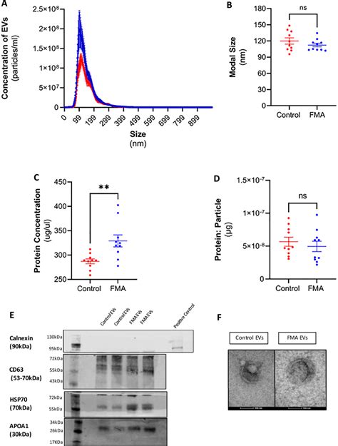 Isolation And Characterisation Of Evs Isolated From The Plasma Of