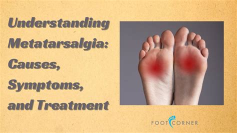 Understanding Metatarsalgia Causes Symptoms And Treatment