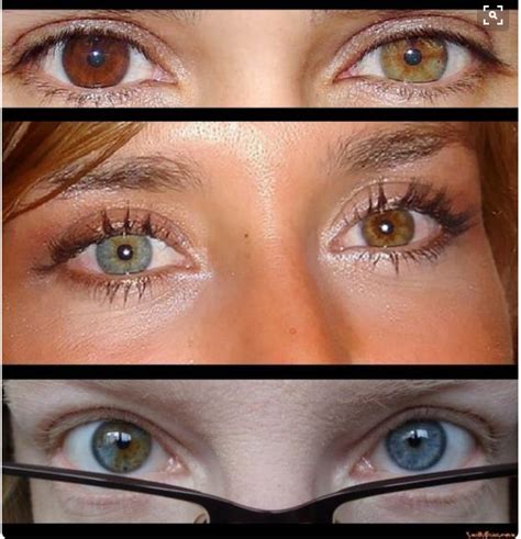 Heterochromia Is Used To Describe Where A Person Has Different Colored