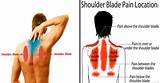 Photos of Pain On Left Side Of Spine Between Shoulder Blades
