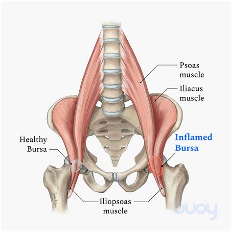 This is important, because true hip joint issues are typically associated with groin pain. Muscles In Your Hip Area - Hip Muscle Strains Info Florida Orthopaedic Institute / Hip muscle ...