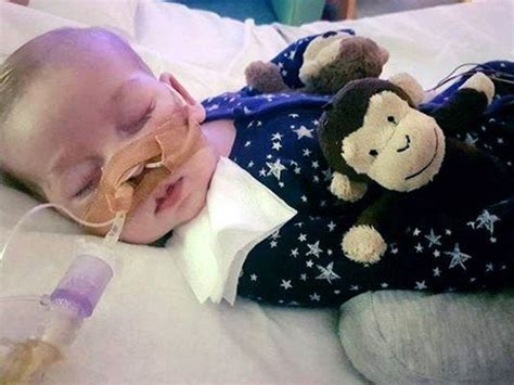 Charlie Gard What To Know About His Rare Condition