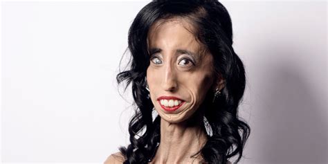 How Being Called The Worlds Ugliest Woman Transformed Her Life The