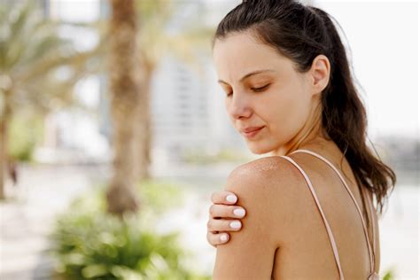 The Stages Of A Sunburn How A Sunburn Affects Your Skin The Derm