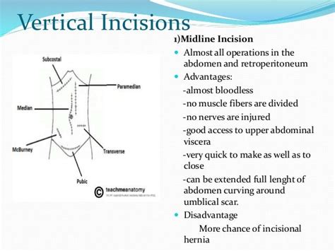 Skin Incisions