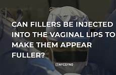 vaginal fillers