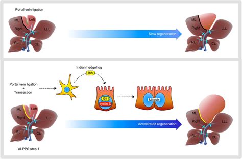 Liverpool vs real madrid promo. Hedgehog pathway mediates early acceleration of liver ...