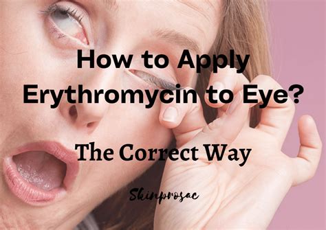 How To Apply Erythromycin To Eye The Right Way Guide Skinprosac
