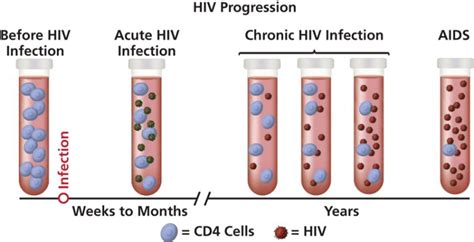 Stages Of Hiv Infection Term Life Med Log Your Everyday Health Blog