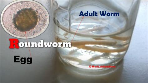 Adult Roundworm And Its Egg Demonstration Youtube