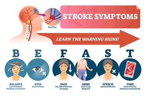 Stroke Symptoms Vector Illustration Signs Of Sudden Blood Clot In Head