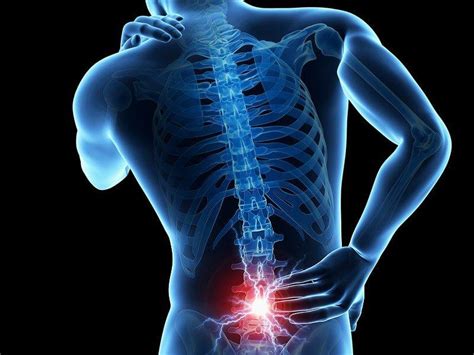 Chiropractic Treatment For Lower Back Pain Advanced Spine And Sports