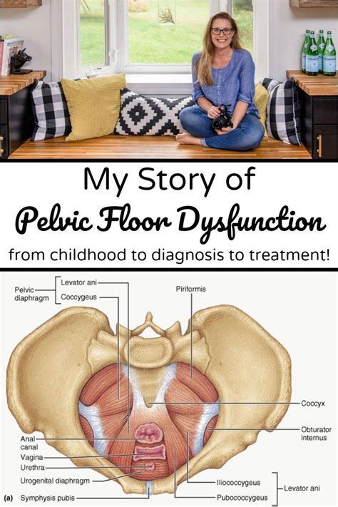 My Story Of Pelvic Floor Dysfunction From Childhood To Diagnosis To