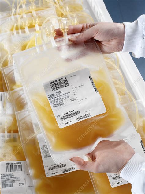 Pooled Blood Platelets Stock Image M5300545 Science Photo Library