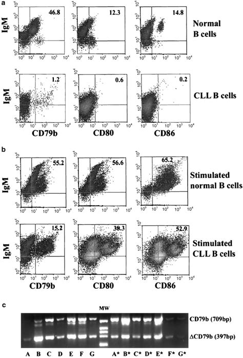 Cll B Cells Surface Expression And Cd79b Transcripts Before And After