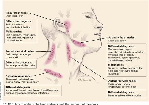 Upper Respiratory Infection Lymph Nodes Human Anatomy