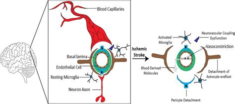 Schematic Representation Of The Detrimental Events Following Ischemic