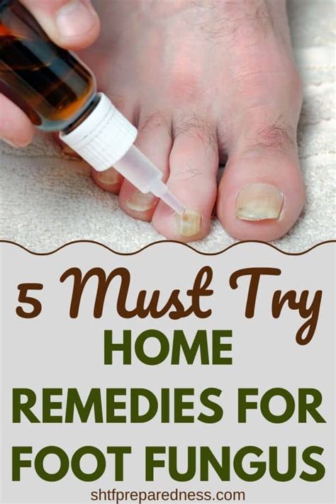 5 Must Try Home Remedies For Foot Fungus Shtfpreparedness Foot