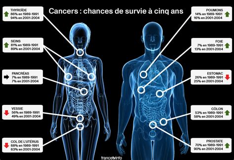 Cancer Quelles Sont Les Chances De Survie à Cinq Ans