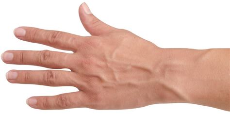 Hand Veins And Aging Vein Institute Vein Specialists