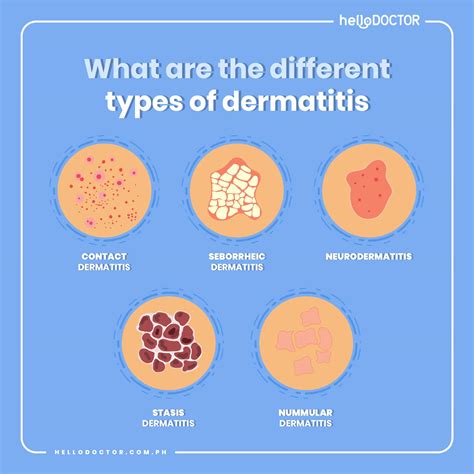 Different Types Of Dermatitis