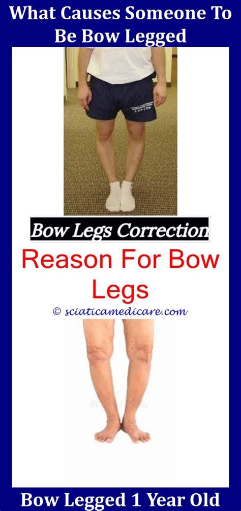Bow legs don't usually bother young children because the condition doesn't cause pain or discomfort. Bow Leg Correction Brace